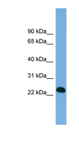BCL7A antibody LS-C110912 Western blot of Fetal lung lysate.