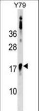 BCL7B Antibody western blot of Y79 cell line lysates (35 ug/lane). The BCL7B antibody detected the BCL7B protein (arrow).