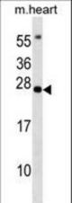 BCL7B Antibody western blot of mouse heart tissue lysates (35 ug/lane). The BCL7B antibody detected the BCL7B protein (arrow).