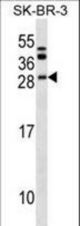 BCL7C Antibody western blot of SK-BR-3 cell line lysates (35 ug/lane). The BCL7C antibody detected the BCL7C protein (arrow).