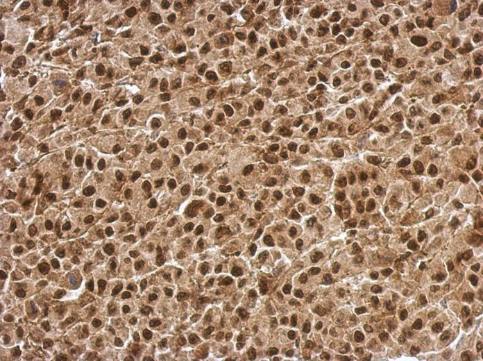 IHC of paraffin-embedded HBL435 xenograft, using BCL7C antibody at 1:500 dilution.