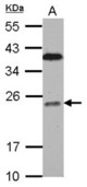 Sample (30 ug of whole cell lysate) A: Jurkat 12% SDS PAGE BCL7C antibody diluted at 1:1000