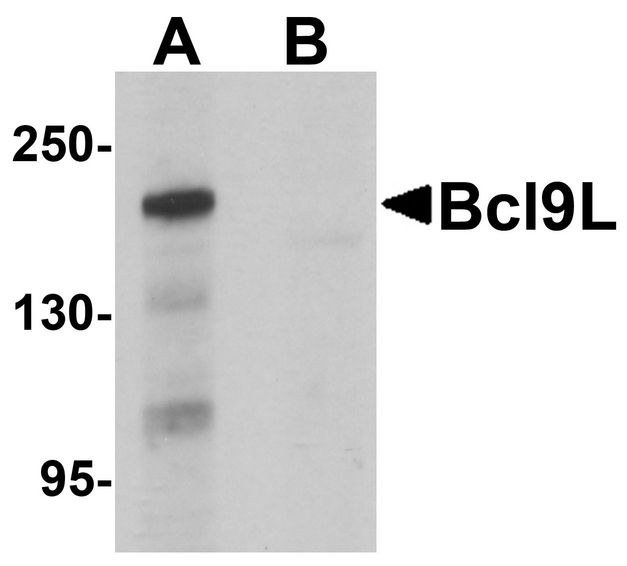 Western blot analysis of Bcl9L in HeLa cell lysate with Bcl9L antibody at 1 ug/ml in (A) the absence and (B) the presence of blocking peptide.