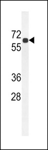 BCDO2 Antibody western blot of mouse kidney tissue lysates (35 ug/lane). The BCDO2 antibody detected the BCDO2 protein (arrow).