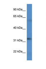 BCO2 antibody LS-C135829 Western blot of HT1080 Cell lysate. Antibody concentration 1 ug/ml.