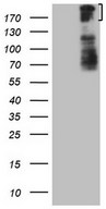 HEK293T cells were transfected with the pCMV6-ENTRY control (Left lane) or pCMV6-ENTRY BCOR (Right lane) cDNA for 48 hrs and lysed. Equivalent amounts of cell lysates (5 ug per lane) were separated by SDS-PAGE and immunoblotted with anti-BCOR.