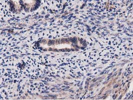 IHC of paraffin-embedded Human endometrium tissue using anti-ACOT12 mouse monoclonal antibody.