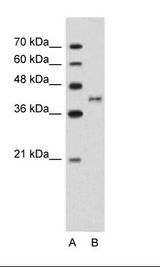 A: Marker, B: Jurkat Cell Lysate