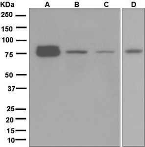 Western blot analysis on (A) NIH/3T3, (B) SH-SY5Y, (C) JAR, and (D) 293T cell lysates using anti-BDKRB2 antibody.