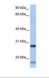 Fetal liver lysate. Antibody concentration: 1.0 ug/ml. Gel concentration: 12%.