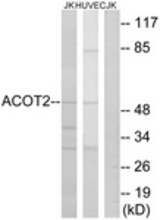 Western blot of extracts from Jurkat/HUVEC cells, using ACOT2 Antibody. The lane on the right is treated with the synthesized peptide.