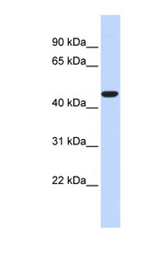 ACOT2 antibody LS-C101957 Western blot of Fetal Heart lysate.