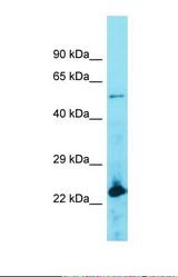 Western blot of Human Lymph Node Tumor. ACOT4 antibody dilution 1.0 ug/ml.