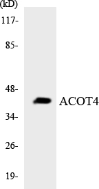 Western blot of the lysates from COLO205 cells using ACOT4 antibody.