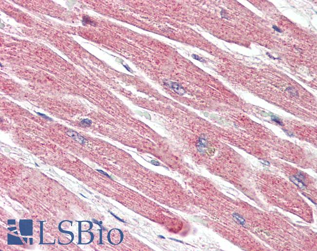 Anti-BECN1 / Beclin-1 antibody IHC of human heart. Immunohistochemistry of formalin-fixed, paraffin-embedded tissue after heat-induced antigen retrieval. Antibody LS-B3203 concentration 5 ug/ml.