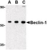 Western blot of Beclin-1 in 293 cell lysate with Beclin-1 antibody at (A) 0.5, (B) 1 and (C) 2 ug/ml.