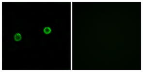 Immunofluorescence of MCF7 cells, using ACOT4 Antibody. The picture on the right is treated with the synthesized peptide.