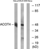 Western blot of extracts from HeLa/COLO cells, using ACOT4 Antibody. The lane on the right is treated with the synthesized peptide.