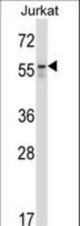 BECN1 Antibody (pT72) western blot of Jurkat cell line lysates (35 ug/lane). The BECN1 antibody detected the BECN1 protein (arrow).
