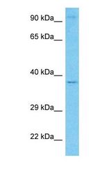 Western blot of BACH Antibody with human 293T Whole Cell lysate.