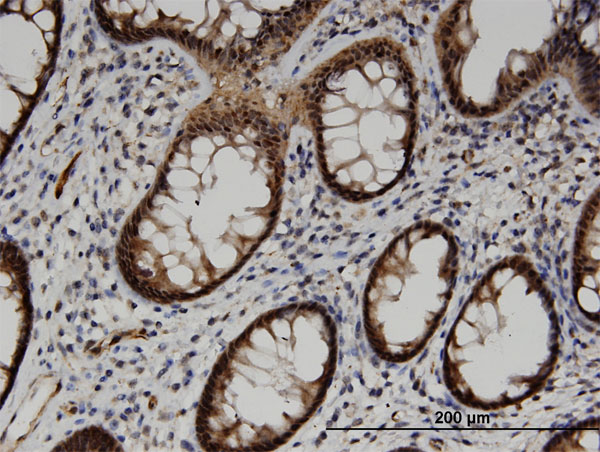 Immunoperoxidase of monoclonal antibody to ACOT7 on formalin-fixed paraffin-embedded human colon. [antibody concentration 3 ug/ml]