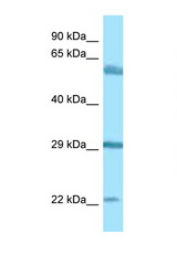 BEGAIN antibody LS-C146502 Western blot of 721_B Cell lysate. Antibody concentration 1 ug/ml.