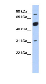 BEND2 / CXorf20 antibody LS-C110882 Western blot of MCF7 cell lysate.