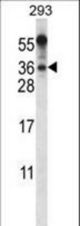 BEND6 Antibody western blot of 293 cell line lysates (35 ug/lane). The BEND6 antibody detected the BEND6 protein (arrow).