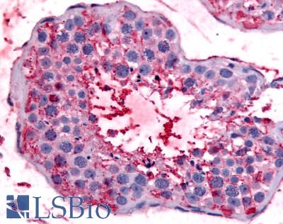 Anti-BEST2 / Bestrophin-2 antibody LS-A8721 IHC of human testis. Immunohistochemistry of formalin-fixed, paraffin-embedded tissue after heat-induced antigen retrieval.