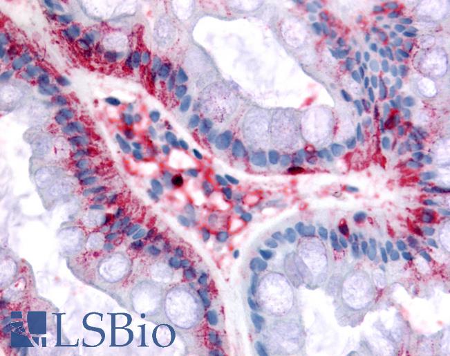 Anti-BEST4 antibody LS-A8520 IHC of human colon. Immunohistochemistry of formalin-fixed, paraffin-embedded tissue after heat-induced antigen retrieval.