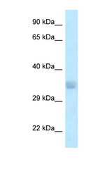 ACOT8 antibody LS-C145634 Western blot of 721_B Cell lysate. Antibody concentration 1 ug/ml.