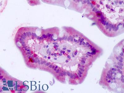 Anti-BEST4 antibody IHC of human small intestine. Immunohistochemistry of formalin-fixed, paraffin-embedded tissue after heat-induced antigen retrieval. Antibody LS-A8523 dilution 2.5 ug/ml.