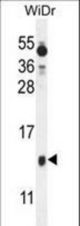 BEX1 Antibody western blot of WiDr cell line lysates (35 ug/lane). The BEX1 antibody detected the BEX1 protein (arrow).