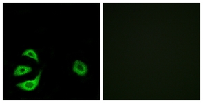 Immunofluorescence of A549 cells, using ACOT8 Antibody. The picture on the right is treated with the synthesized peptide.