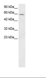 Jurkat Cell Lysate