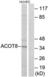 Western blot of extracts from HUVEC cells, using ACOT8 Antibody. The lane on the right is treated with the synthesized peptide.