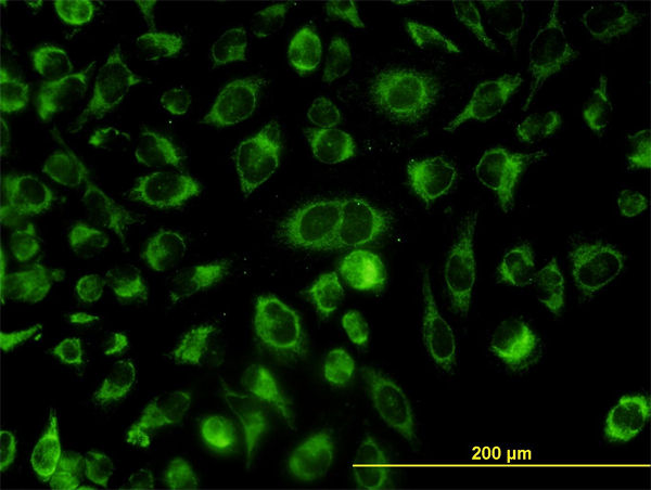 Immunofluorescence of monoclonal antibody to ACOT9 on HeLa cell (antibody concentration 10 ug/ml).