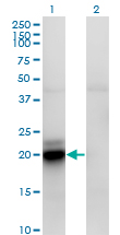 Western blot of ACOT9 expression in transfected 293T cell line by ACATE2 monoclonal antibody, clone 4E4.