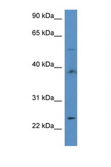 ACOT9 antibody LS-C135890 Western blot of 435S Cell lysate. Antibody concentration 1 ug/ml.