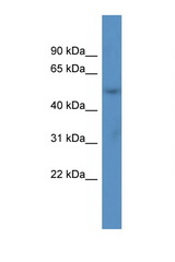 ACOT9 antibody LS-C135891 Western blot of Fetal Lung lysate. Antibody concentration 1 ug/ml.