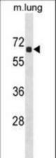 ACOT9 Antibody western blot of mouse lung tissue lysates (35 ug/lane). The ACOT9 antibody detected the ACOT9 protein (arrow).