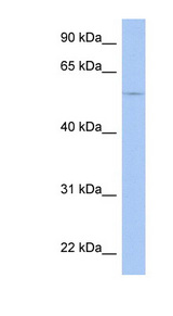 TRIM58 antibody LS-C112140 Western blot of HepG2 cell lysate.
