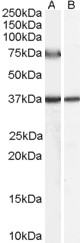 Antibody (0.5 ug/ml) staining of Human Liver lysate (35 ug protein in RIPA buffer) with (B) and without (A) blocking with the immunizing peptide. Primary incubation was 1 hour. Detected by chemiluminescence.