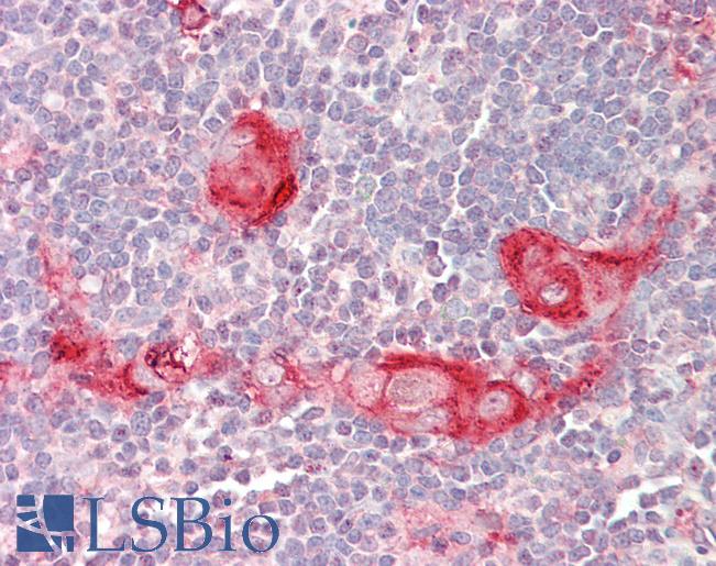 Anti-BID antibody IHC staining of human thymus. Immunohistochemistry of formalin-fixed, paraffin-embedded tissue after heat-induced antigen retrieval.