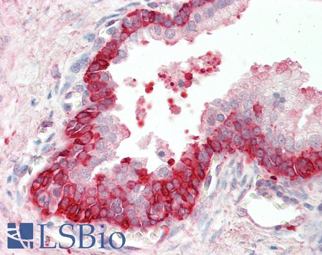 Anti-BID antibody IHC staining of human prostate. Immunohistochemistry of formalin-fixed, paraffin-embedded tissue after heat-induced antigen retrieval. Antibody LS-B11168 concentration 5 ug/ml.