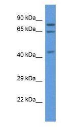 ACOX3 antibody Western Blot of 721_B.