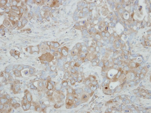 IHC of paraffin-embedded H441 xenograft using ACOX3 antibody at 1:500 dilution.