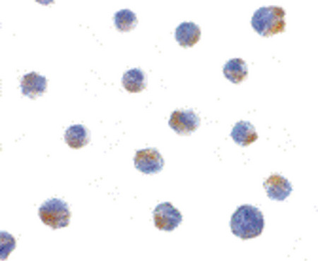 Immunocytochemistry of BIK in Jurkat cells with BIK antibody at 1 ug/ml.