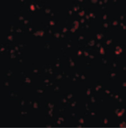 Immunofluorescence of Bik in Jurkat cells with Bik antibody at 10 ug/ml.