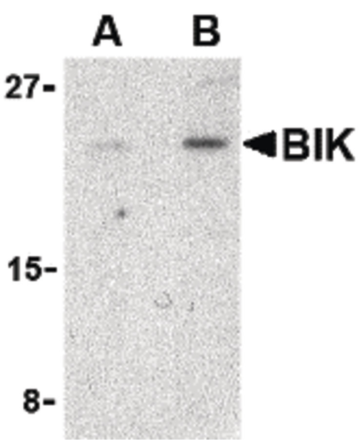 Western blot of BIK in Jurkat cell lysate with BIK antibody at (A) 1 and (B) 2 ug/ml.